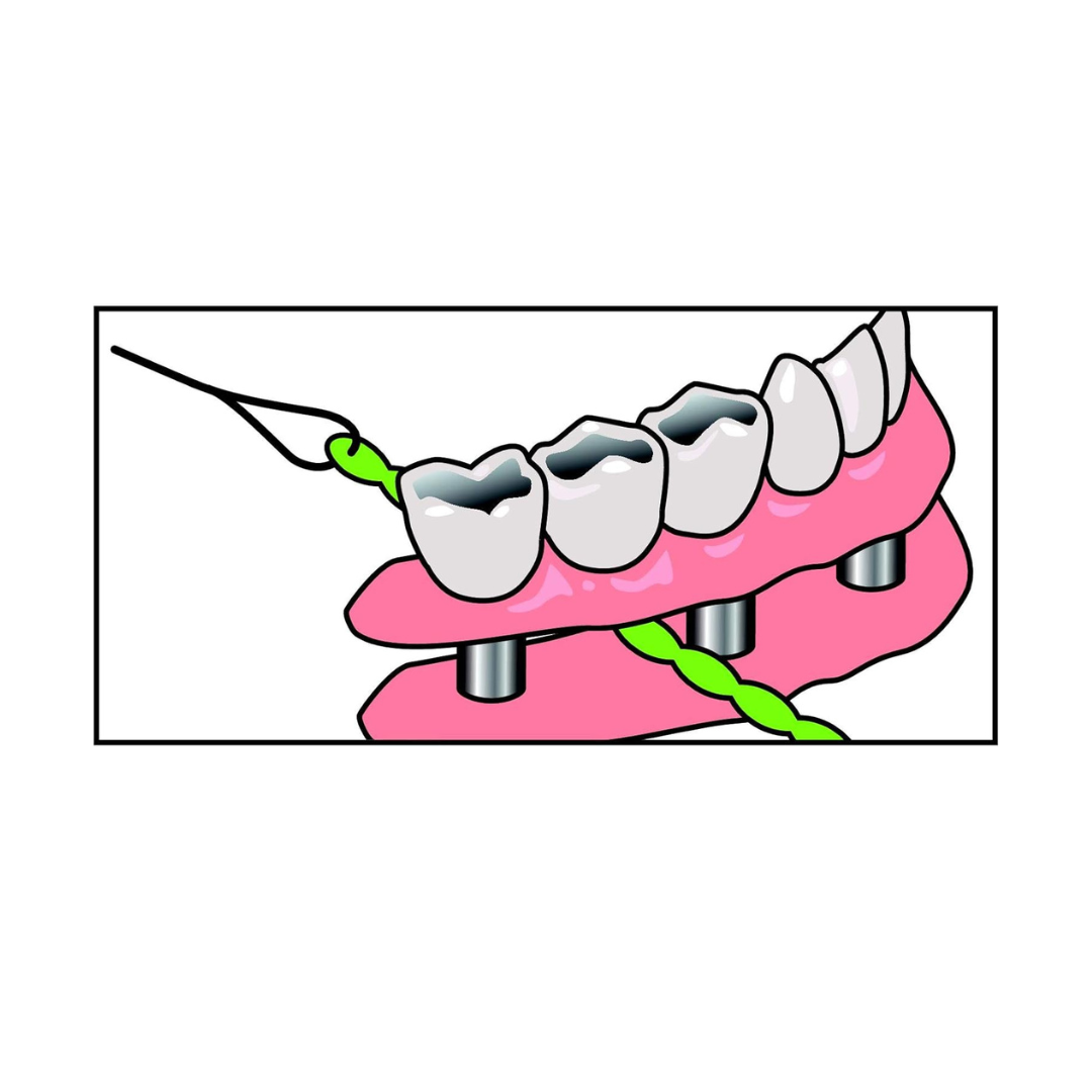 IDontix Brace X-Floss, Green