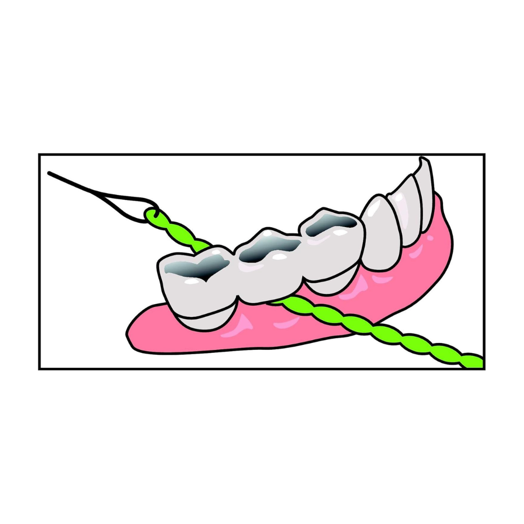 IDontix Brace X-Floss, Green
