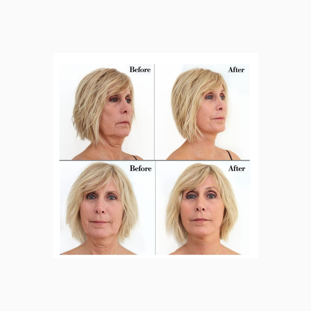 Bring It Up Instant Neck Lift Tape 30 Day Supply, Transparent Neck Lifting Anti Wrinkle Stickers