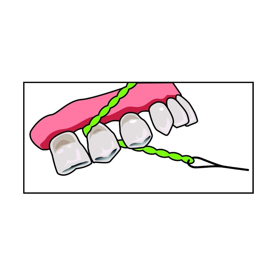 IDontix Brace X-Floss, Green