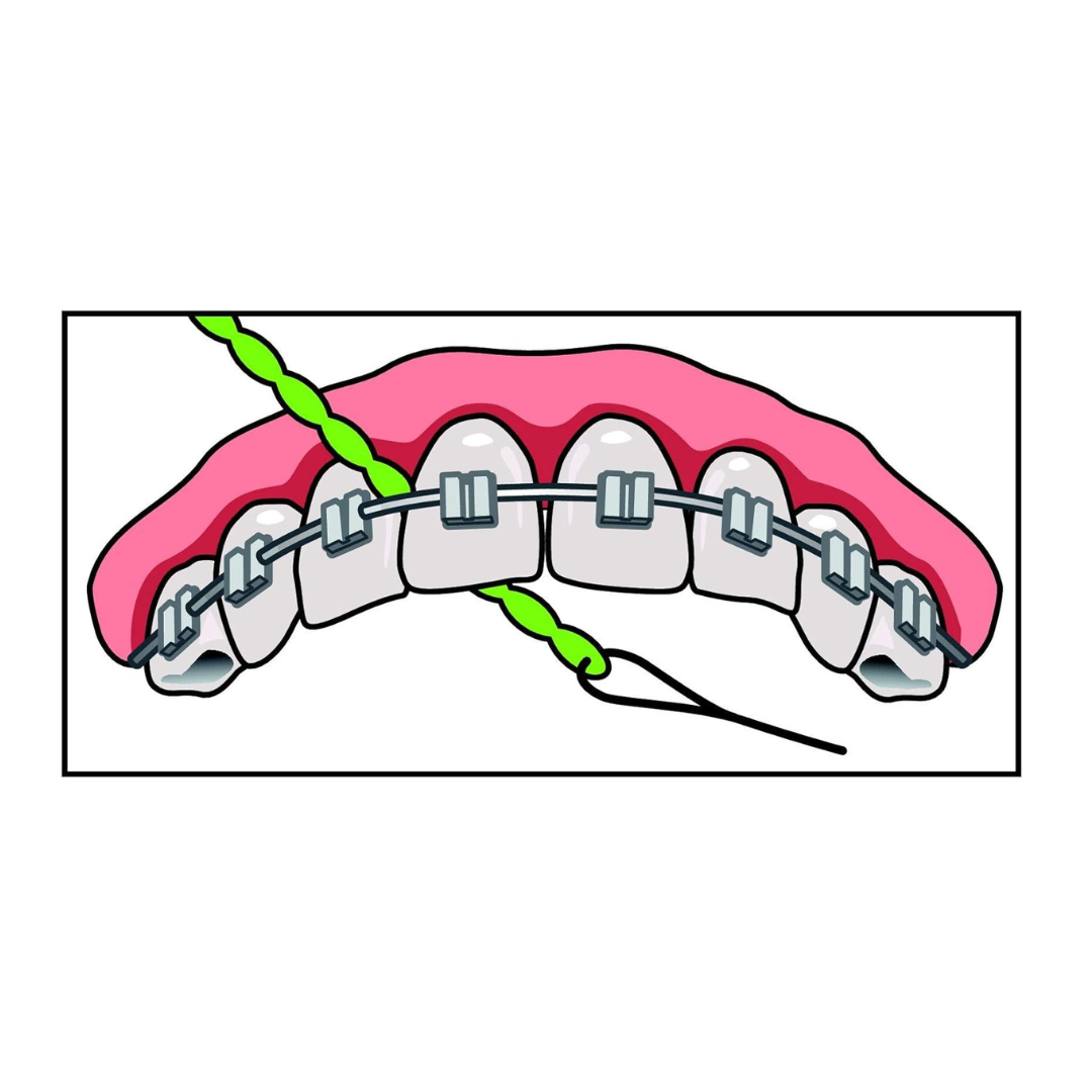 IDontix Brace X-Floss, Green